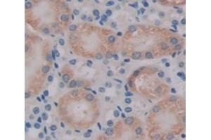 IHC-P analysis of kidney tissue, with DAB staining. (TMOD3 antibody  (AA 1-352))