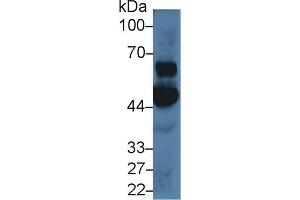 Detection of OAS1 in Porcine Cerebrum lysate using Polyclonal Antibody to 2',5'-Oligoadenylate Synthetase 1 (OAS1) (OAS1 antibody  (AA 74-165))