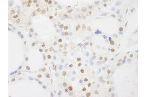 anti-BRF1, RNA polymerase III transcription initiation factor subunit (BRF1) (AA 627-677) antibody