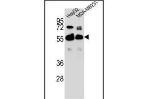RGDS1 Antibody (Center) 1945c western blot analysis in HepG2,MDA-M cell line lysates (35 μg/lane). (RAP1GDS1 antibody  (AA 217-244))