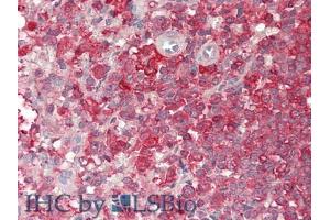 IHC-P analysis of Human Spleen Tissue, with HE staining. (PCSK9 antibody  (AA 454-679))