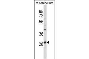 Western blot analysis of hPPT1-C46 in mouse cerebellum tissue lysates (35ug/lane) (PPT1 antibody  (N-Term))