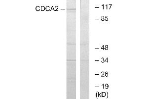 Western blot analysis of extracts from 293 cells, using CDCA2 antibody. (CDCA2 antibody)