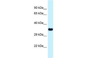 WB Suggested Anti-Ctsz Antibody   Titration: 1. (Cathepsin Z antibody  (N-Term))