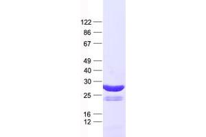 Validation with Western Blot (OSR1 Protein (His tag))