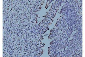 IHC analysis of EIF4A1 using anti-EIF4A1 antibody (ABIN7603144). (EIF4A1 antibody  (N-Term))