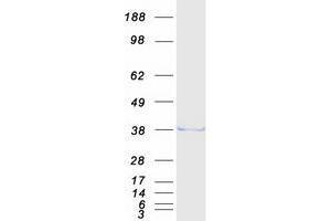 Validation with Western Blot