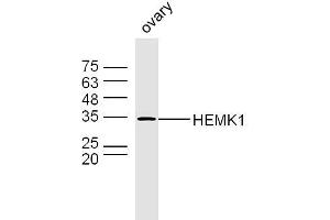 Mouse ovary lysates probed with HEMK1 Polyclonal Antibody, Unconjugated  at 1:300 dilution and 4˚C overnight incubation. (HEMK1 antibody  (AA 21-120))