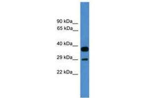 Image no. 1 for anti-OTU Domain, Ubiquitin Aldehyde Binding 2 (OTUB2) (AA 91-140) antibody (ABIN6745385) (OTUB2 antibody  (AA 91-140))