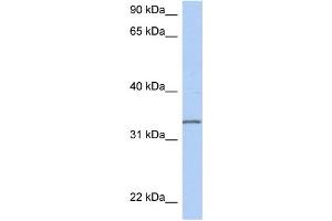 WB Suggested Anti-C3orf62 Antibody Titration: 0. (C3orf62 antibody  (Middle Region))