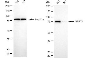 Western blotting analysis using GFPT1 antibody (ABIN7798748). (Recombinant GFPT1 antibody)
