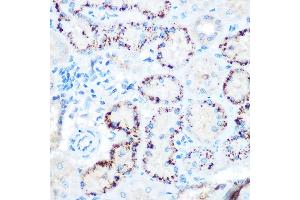 Immunohistochemistry of paraffin-embedded rat kidney using  Rabbit pAb (ABIN3015826, ABIN3015827, ABIN3015828 and ABIN6219178) at dilution of 1:100 (40x lens). (ANGPTL4 antibody  (AA 26-406))