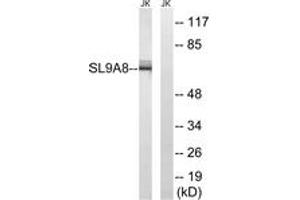 Western Blotting (WB) image for anti-Solute Carrier Family 9 (Sodium/hydrogen Exchanger), Member 8 (SLC9A8) (AA 451-500) antibody (ABIN2890644) (NHE8 antibody  (AA 451-500))