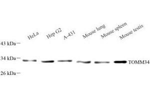 Western blot analysis of TOMM34 (ABIN7075984) at dilution of 1: 1000 (TOMM34 antibody)