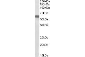 ABIN1590108 (1µg/ml) staining of HeLa nuclear lysate (35µg protein in RIPA buffer). (E2F1 antibody  (AA 314-327))