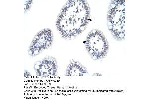 Rabbit Anti-HNRPD Antibody  Paraffin Embedded Tissue: Human Intestine Cellular Data: Epithelial cells of intestinal villas Antibody Concentration: 4. (HNRNPD/AUF1 antibody  (N-Term))