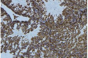Immunohistochemistry (IHC) image for anti-Microtubule-Associated Protein tau (MAPT) (C-Term) antibody (ABIN6263123)