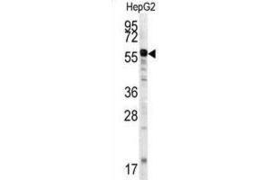 Western Blotting (WB) image for anti-Matrix Metalloproteinase 20 (MMP20) antibody (ABIN3002549)