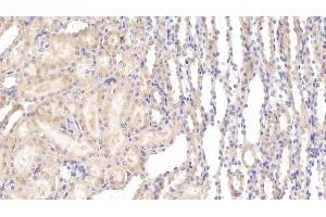 Immunohistochemistry (IHC) image for anti-delta-Like 4 (DLL4) (AA 215-331) antibody (ABIN7436639)