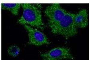 Anti-Rab2S Ab at 1/1,000 dilution, HEK293 cells transfected With GFP-Rab25, rabbit polyclonal to goat lµg (HRP) at 1/10,000 dilution, (RAB25 antibody  (C-Term))