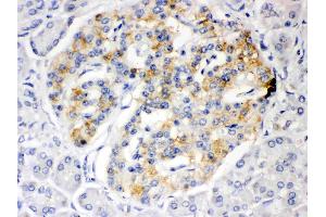 ISG15 was detected in paraffin-embedded sections of human pancreatic cancer tissues using rabbit anti- ISG15 Antigen Affinity purified polyclonal antibody (Catalog # ) at 1 µg/mL. (ISG15 antibody  (AA 2-157))