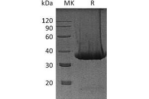 Western Blotting (WB) image for Kallikrein 1 (KLK1) protein (His tag) (ABIN7320811) (Kallikrein 1 Protein (KLK1) (His tag))