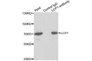 Immunoprecipitation analysis of 150ug extracts of Jurkat cells using 3ug LCP1 antibody. (LCP1 antibody  (AA 1-270))