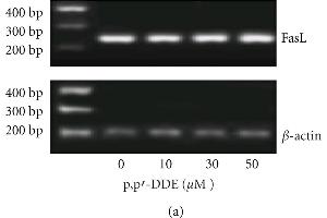 Effects of different p,p'-DDE concentrations on the FasL and caspase-3 and -8 mRNA in rat Sertoli cells by RT-PCR (a)-(c).