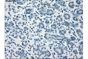 Immunohistochemical staining of paraffin-embedded breast tissue using anti-FCGR2A mouse monoclonal antibody. (FCGR2A antibody)
