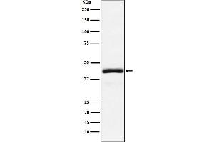 Western blot analysis of NEK2 expression in 293T cell lysate. (Recombinant NEK2 antibody)