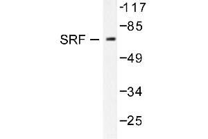 Image no. 1 for anti-Serum Response Factor (SRF) antibody (ABIN271823) (SRF antibody)