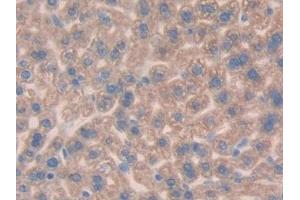 Immunohistochemistry (IHC) image for anti-Mucin 1 (MUC1) (AA 410-525) antibody (ABIN7440383)