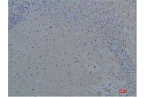 Immunohistochemistry (IHC) analysis of paraffin-embedded Rat Brain Tissue using S100 beta Rabbit Polyclonal Antibody diluted at 1:200. (S100B antibody)