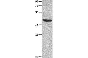 Western blot analysis of Mouse heart tissue, using MMP28 Polyclonal Antibody at dilution of 1:350 (MMP28 antibody)