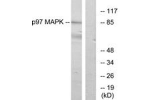 Western blot analysis of extracts from K562 cells, using p97 MAPK Antibody. (MAPK6 antibody  (AA 461-510))