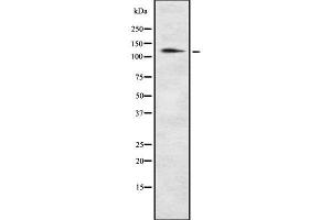 Western blot analysis of POM121 using NIH-3T3 whole cell lysates (POM121 antibody)