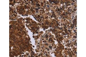 Immunohistochemistry (IHC) image for anti-Formin 2 (FMN2) antibody (ABIN2434662) (Formin 2 antibody)