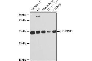 Western blot analysis of extracts of various cell lines, using p53 DINP1 Rabbit mAb (ABIN7271097) at 1:1000 dilution.