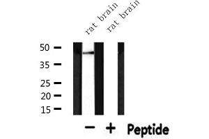 Western blot analysis of extracts from rat brain, using KAP2 Antibody. (PRKAR2A antibody  (N-Term))