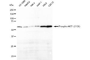 Western blotting analysis using Phospho-AKT1 (S129) antibody (ABIN7800785). (Recombinant AKT1 antibody  (pSer129))