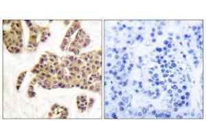 Immunohistochemistry (IHC) image for anti-BCL2-Associated Agonist of Cell Death (BAD) (pSer128), (pSer91) antibody (ABIN1847349) (BAD antibody  (pSer91, pSer128))