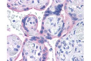 INSR antibody was used for immunohistochemistry at a concentration of 4-8 ug/ml. (Insulin Receptor antibody  (Middle Region))