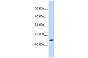 Image no. 1 for anti-Ubiquitin-Conjugating Enzyme E2D 3 (UBE2D3) (N-Term) antibody (ABIN6740793) (UBE2D3 antibody  (N-Term))