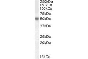 Western Blotting (WB) image for anti-Early Growth Response 4 (EGR4) (Internal Region) antibody (ABIN2465639) (EGR4 antibody  (Internal Region))