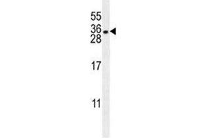 HLA-DQA1 antibody western blot analysis in NCI-H460 lysate.