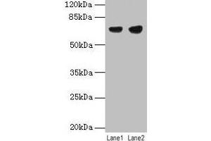 Western blot All lanes: PTPN6 antibody at 12 μg/mL Lane 1: Jurkat whole cell lysate Lane 2: Raji whole cell lysate Secondary Goat polyclonal to rabbit IgG at 1/10000 dilution Predicted band size: 68, 64, 71 kDa Observed band size: 68 kDa (SHP1 antibody  (Isoform 2))