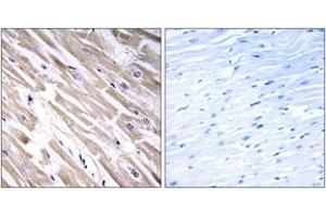 Immunohistochemistry analysis of paraffin-embedded human heart tissue, using FGF18 Antibody.