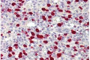 Anti-PARIS / ZNF746 antibody IHC staining of human spleen.