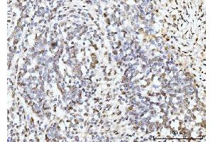 IHC analysis of ARL6IP6 using anti-ARL6IP6 antibody (ABIN7603020). (ARL6IP6 antibody  (Middle Region))