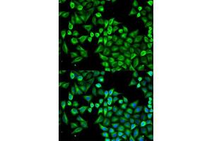 Immunofluorescence analysis of A549 cells using ABAT antibody. (ABAT antibody  (AA 29-300))